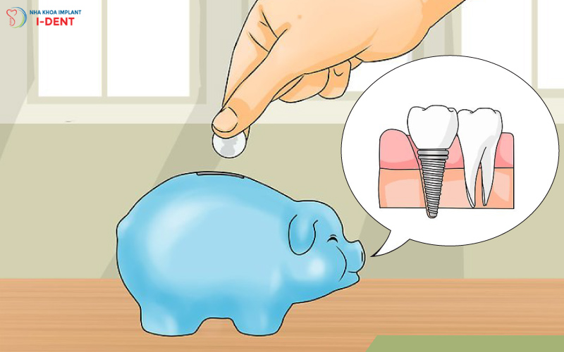 Giá trồng 1 răng Implant được tính như thế nào?